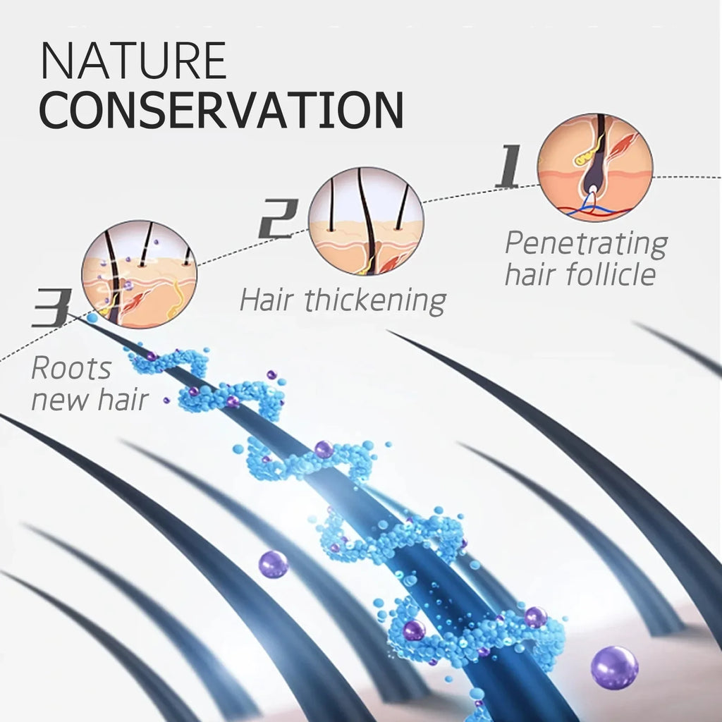 Hair Growth Serum Prevent Baldness Scalp Treatment Longer Thicken Nourishing Strengthen Ginger Regrowth Anti Hair Loss Essence