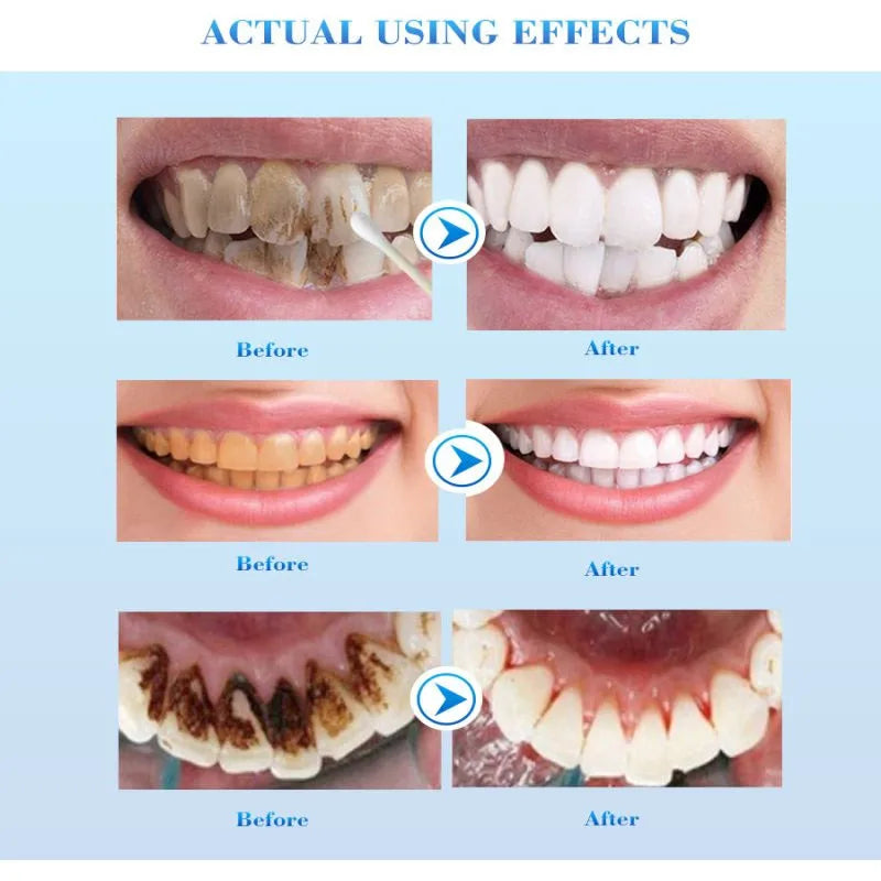 Whitning Toothpaste Freshen Breath Remove Stains Oral Hygiene Clean