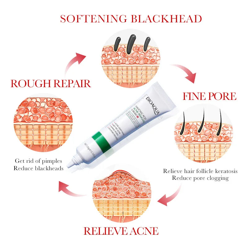 Salicylic Acid Blemish Repair Face Cream – Acne, Blackheads & Pore Refining