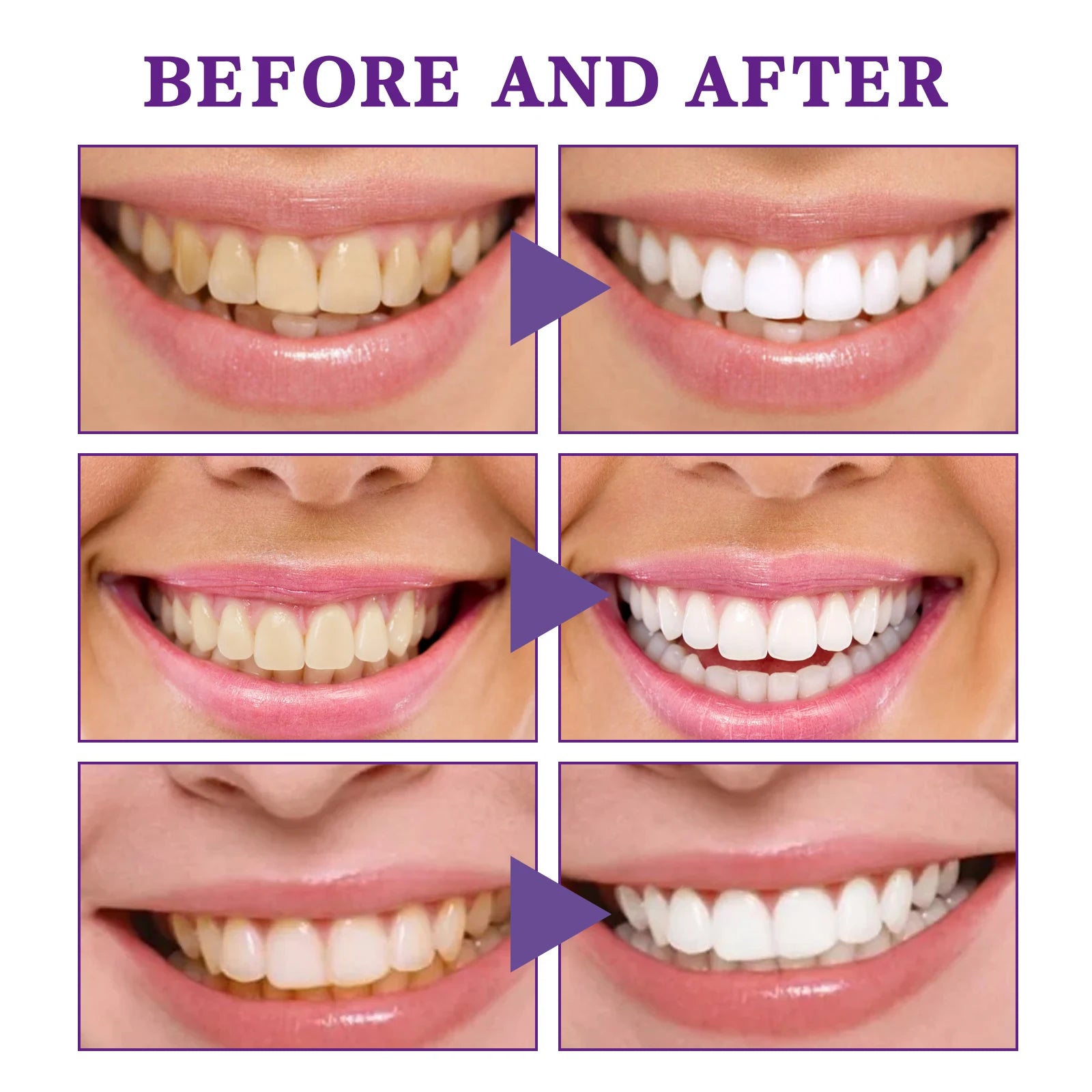 V34 Purple Toothpaste Cleaning Mousse Cleans Teeth, Protects Gums, Freshens Breath Oral Care Pump-Style Toothpaste