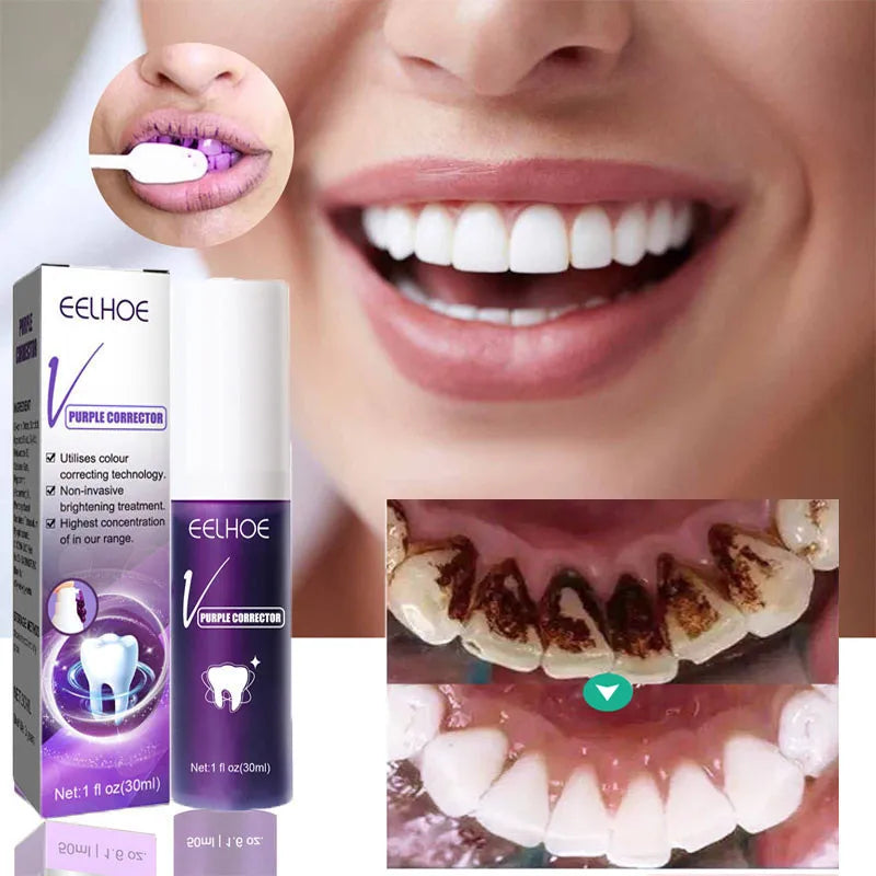 Whitning Toothpaste Freshen Breath Remove Stains Oral Hygiene Clean