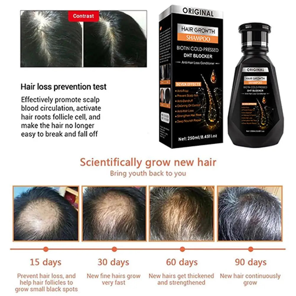 1/2/3Pcs Hair Growth Shampoo, Ginger Shampoo Deep Cleaning Nourish Scalp Deep Cleaning Nourish Scalp Enhance Hair Elasticity