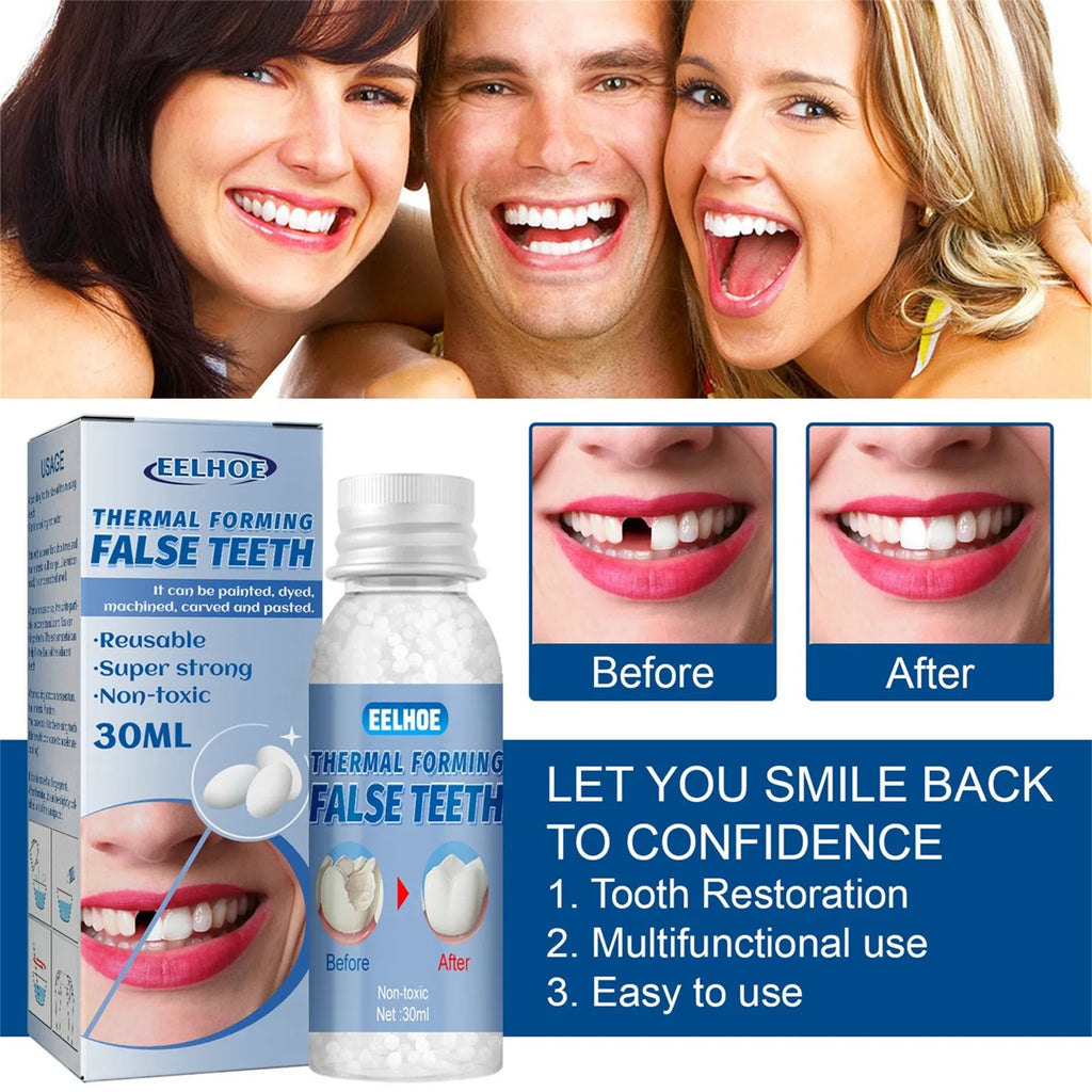 Tooth Repair Glue Shapeable Teeth Gaps Filling Solid Glue Temporary Teeth Repair Falseteeth Glue Safety Dental Supplies