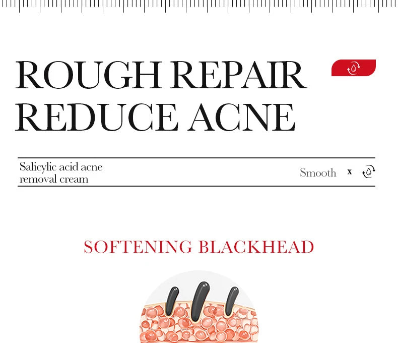 Salicylic Acid Blemish Repair Face Cream – Acne, Blackheads & Pore Refining