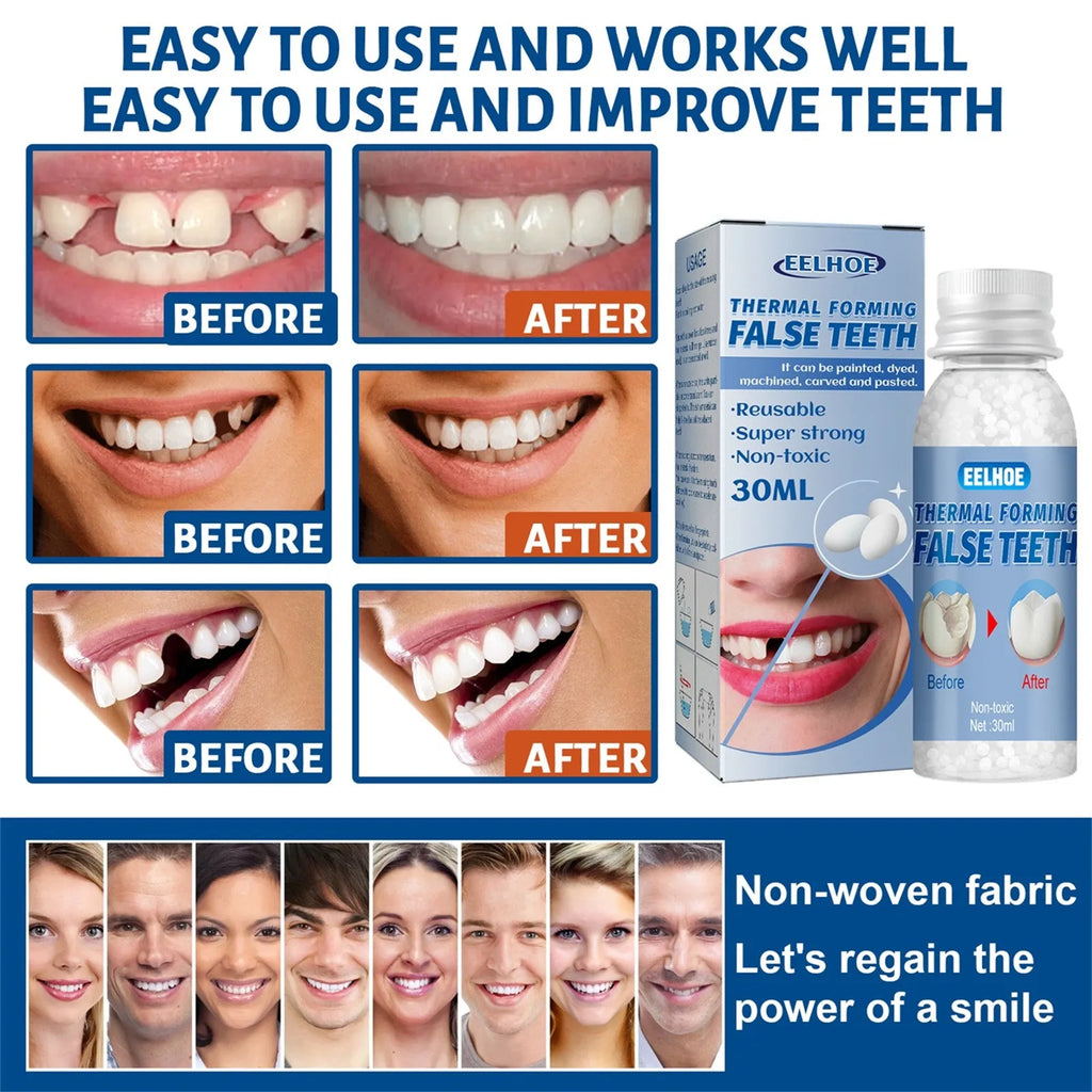 Tooth Repair Glue Shapeable Teeth Gaps Filling Solid Glue Temporary Teeth Repair Falseteeth Glue Safety Dental Supplies