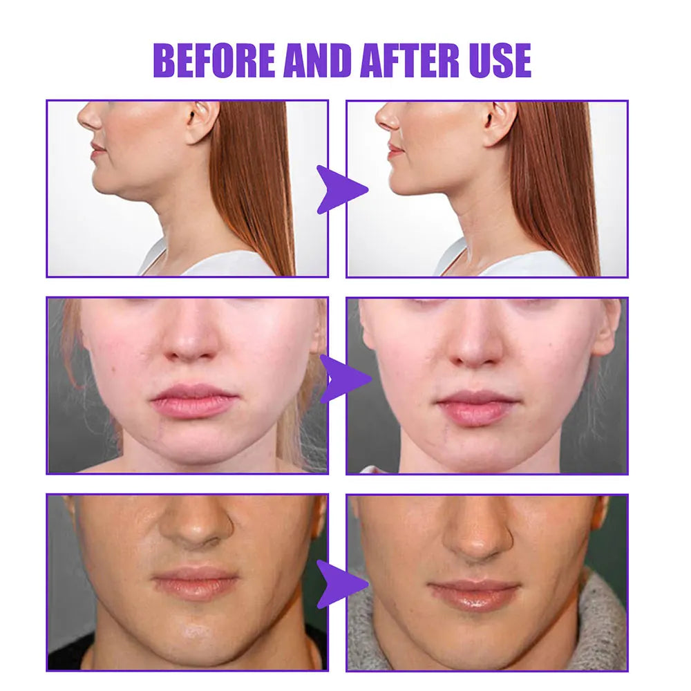 2Pcs Firming Face-lift Slimming Cream V-Shape Slimming Removal Masseter Muscle Double Chin Face Fat Burning Anti-Wrinkle Product