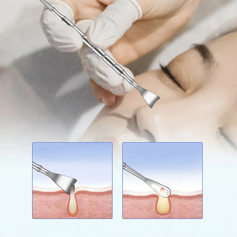 Double Head Stainless Steel Professional Blackhead Remover Blemish Extractor Tool Pimple Comedone Removal For Face