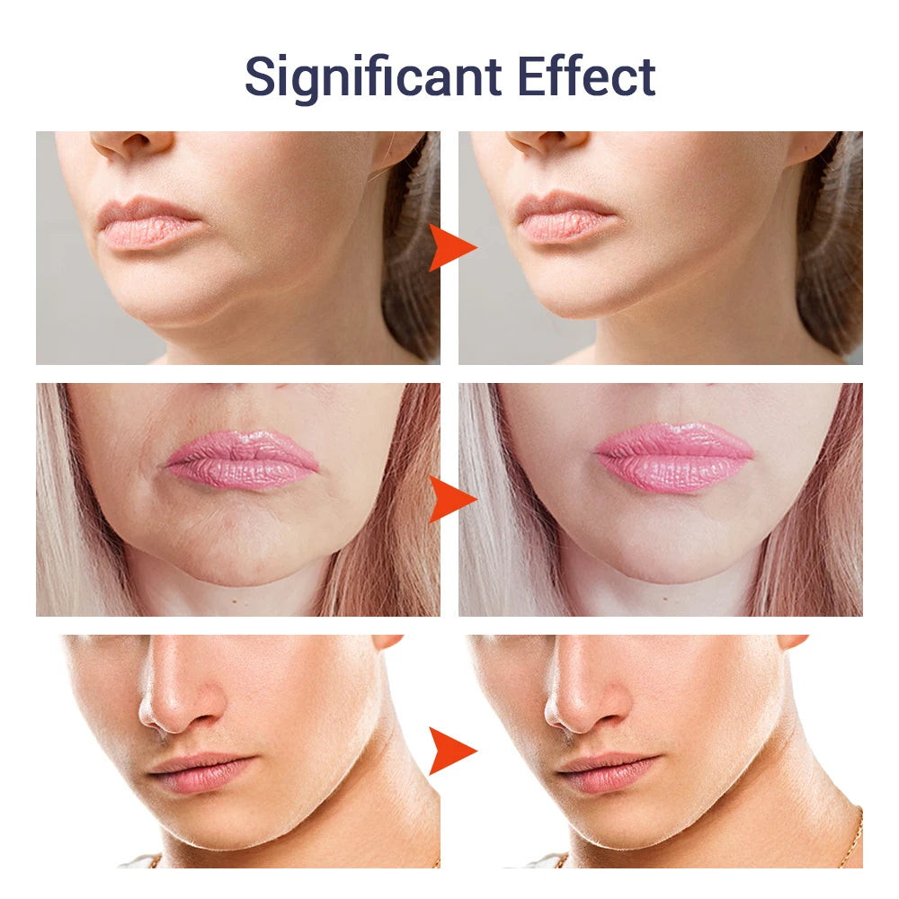 2Pcs Firming Face-lift Slimming Cream V-Shape Slimming Removal Masseter Muscle Double Chin Face Fat Burning Anti-Wrinkle Product
